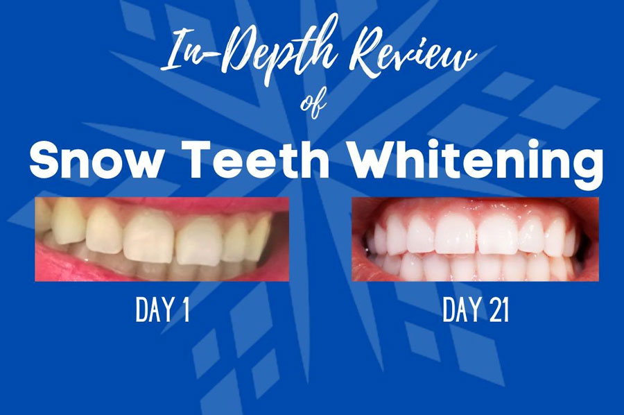 Allemaal Dwars zitten overhandigen Snow Teeth Whitening review + everything you need to know before buying